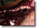 Stomatologie - zubn� v�pln�